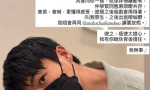 33岁艺人柯炜林分享“患癌治疗”进展